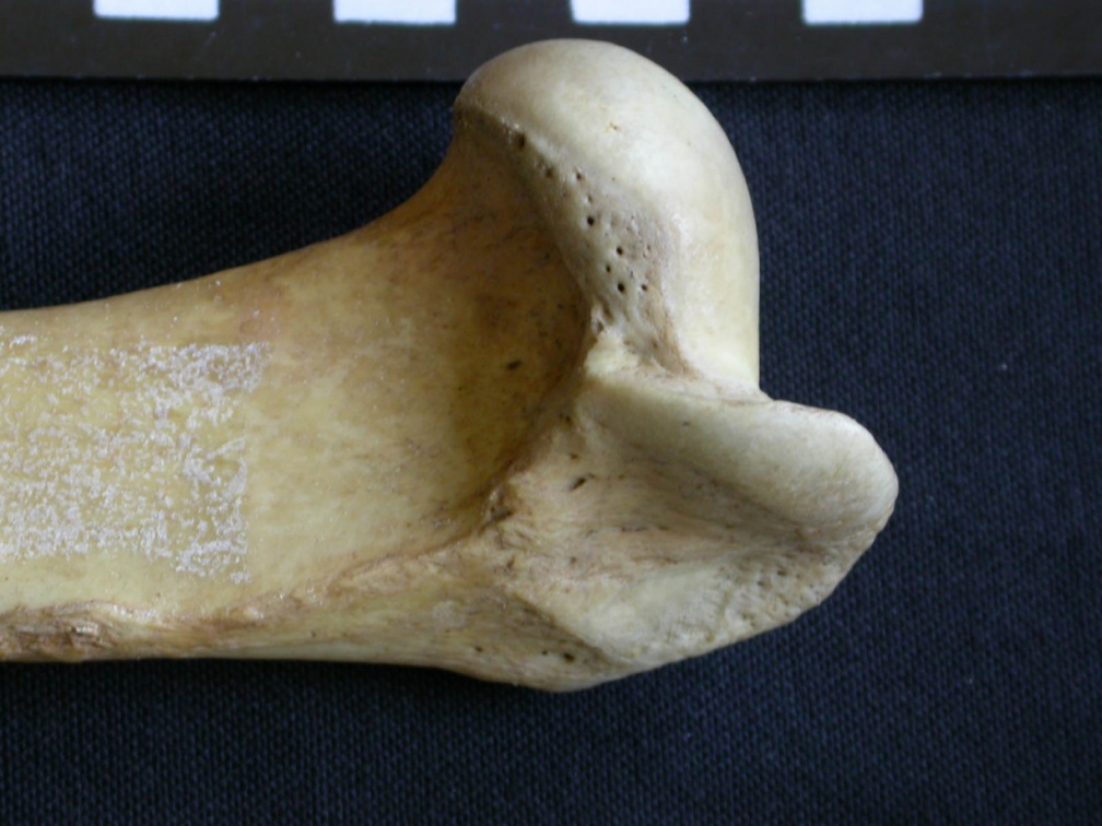 Húmero : parte proximal