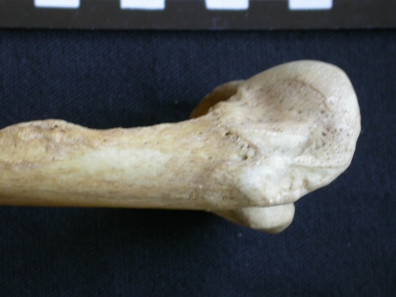 Humerus: proximale part