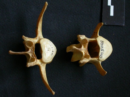 Lumbar vertebrae