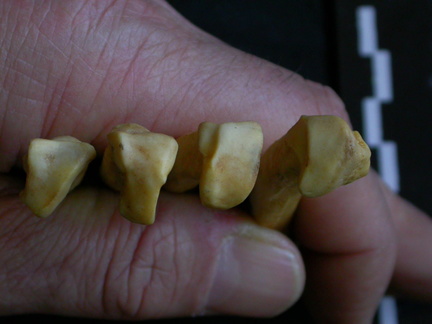 Metacarpianos : parte proximal