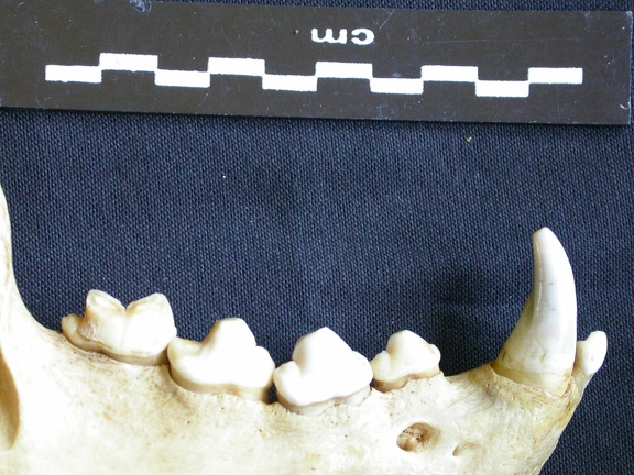 Lower teeth