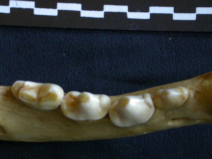 Lower teeth