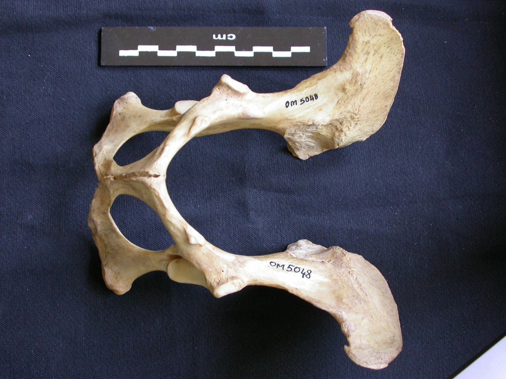 Pelvis