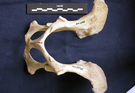 Pelvis