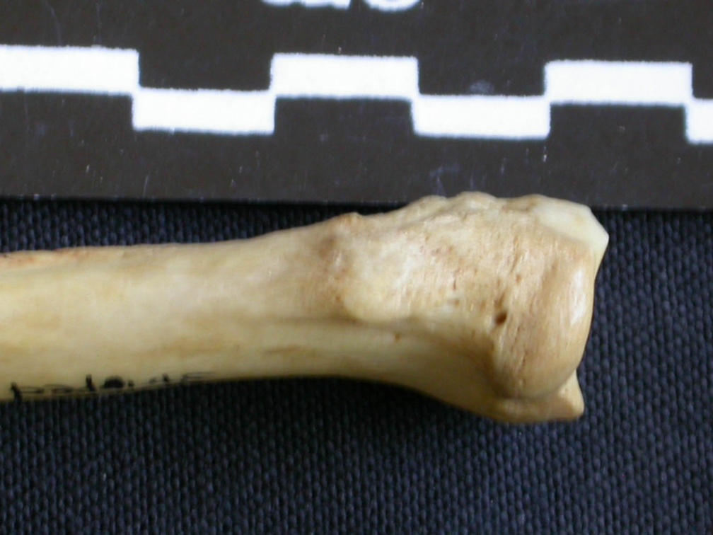 Radius : partie proximale