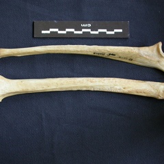 Radius et ulna