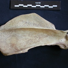 Scapula : vue latérale