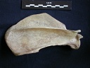 Scapula : vue latérale