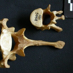 Thoracic vertebrae