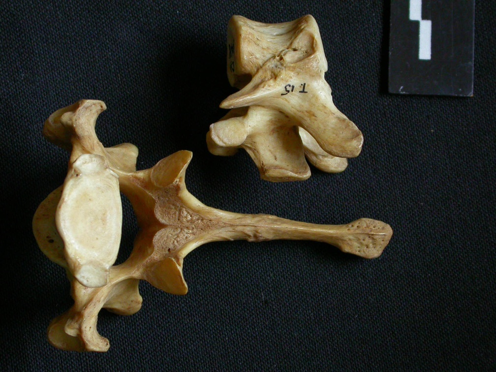 Vértebras torácicas