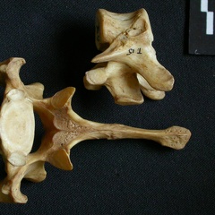 Thoracic vertebrae