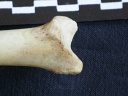  Tibia: distal part