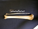 Tibia et fibula
