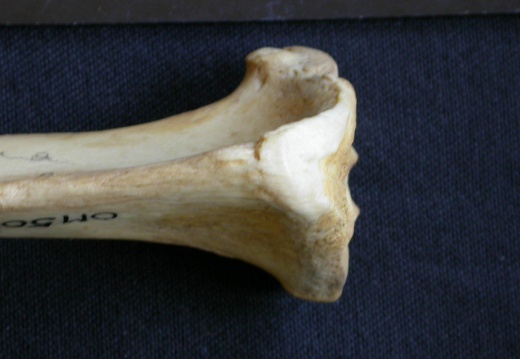  Tibia: proximale part