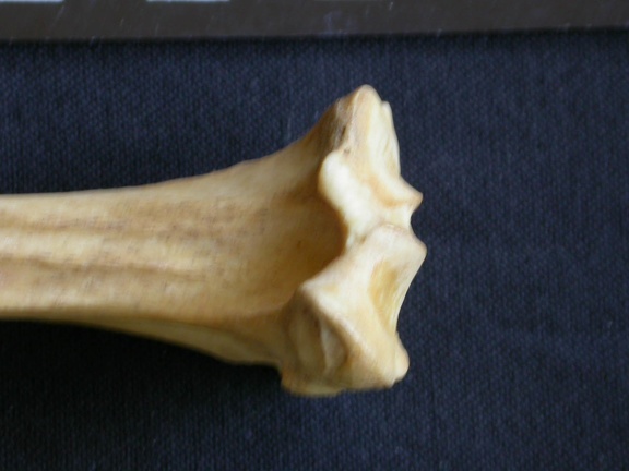  Tibia: proximale part