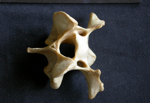 Cervical vertebra