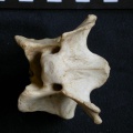 Vertèbre cervicale