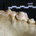 Dentition supérieure