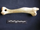 Humerus