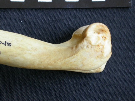 Humerus: distal part