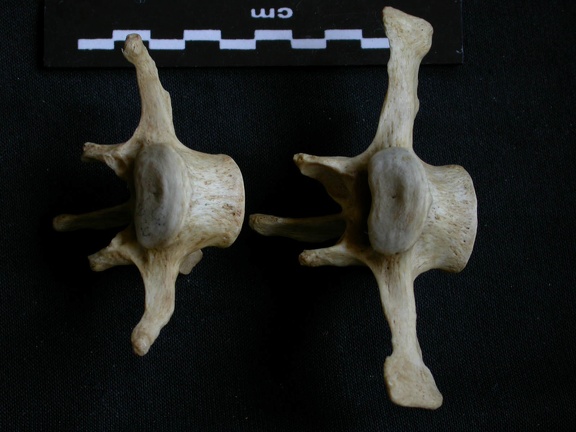 Vértebras posteriores