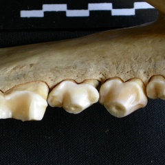 Lower teeth