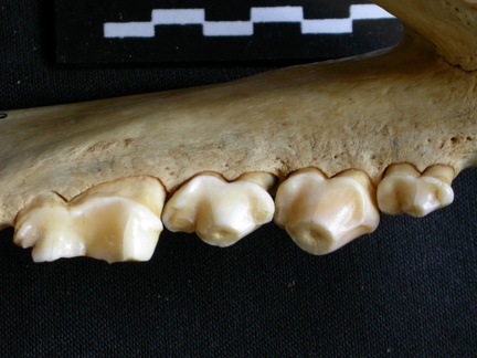 Lower teeth