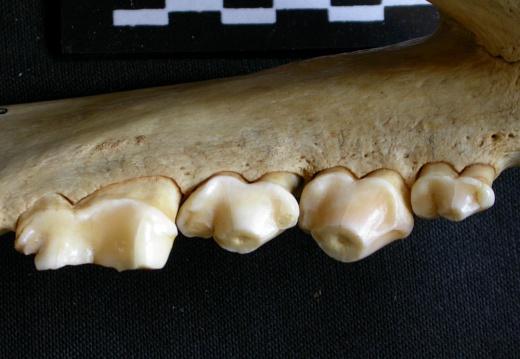 Lower teeth