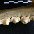 Dentition inférieure