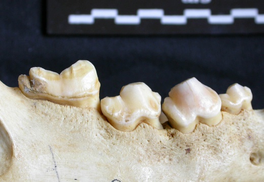 Dentición inferior