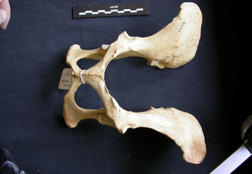 Pelvis