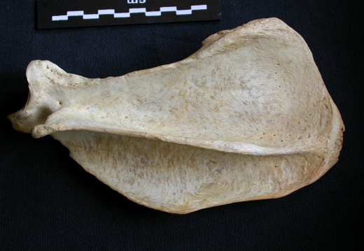 Scapula : vue latérale