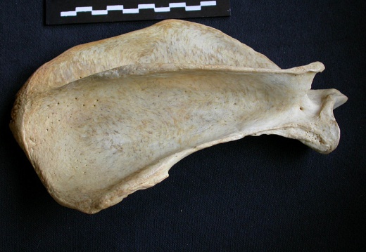 Scapula : vue latérale