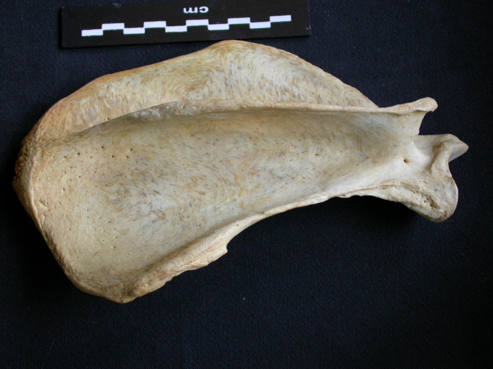 Scapula : vue latérale