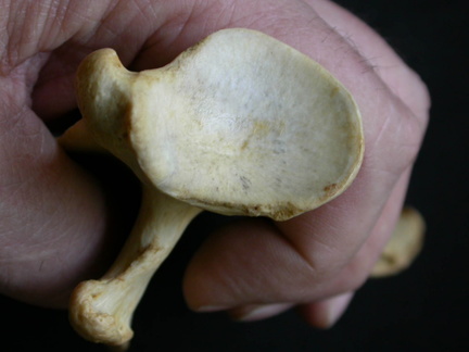 Scapula : vue ventrale