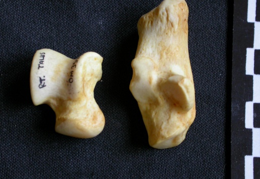 Talus and calcaneus