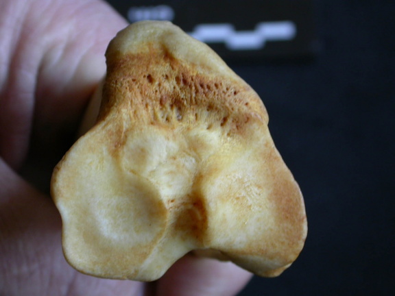  Tibia: proximale part