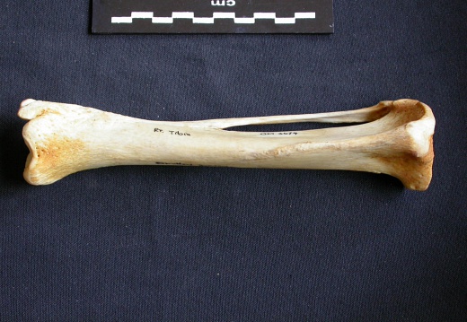 Tibia et fibula (10576 visites) Crocuta crocuta - Adulte - Éléments droitsCollection : Département d'Ostéologie du Musée Nation... Tibia et fibula