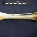 Tibia et fibula