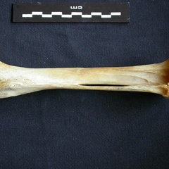 Tibia et fibula