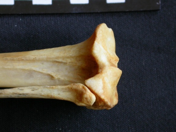 Tibia and fibula: proximale part