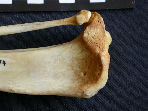 Tibia and fibula: proximale part
