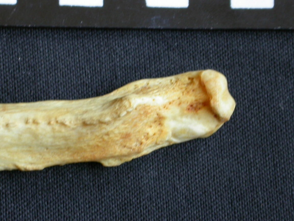  Ulna: distal part