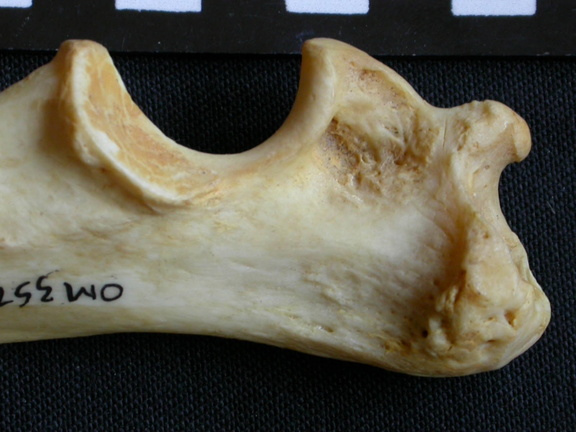  Ulna: proximale part