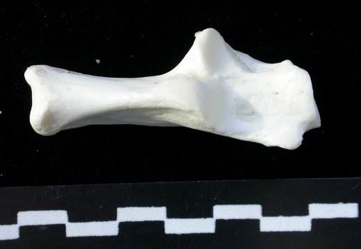 Calcaneus