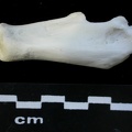 Calcaneus