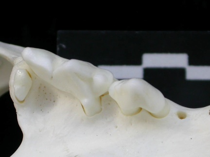 Dentition supérieure