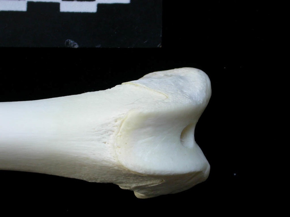 Femur: distal part