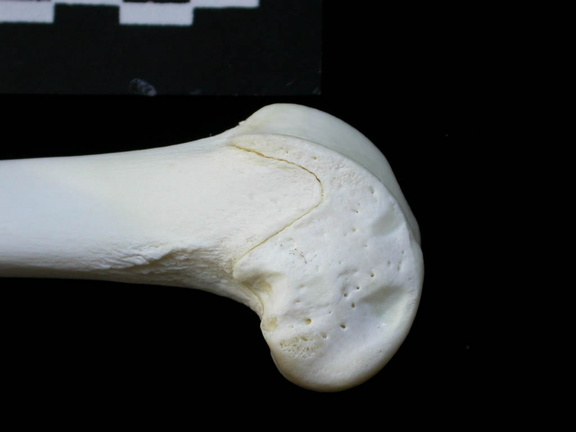 Fémur : partie distale