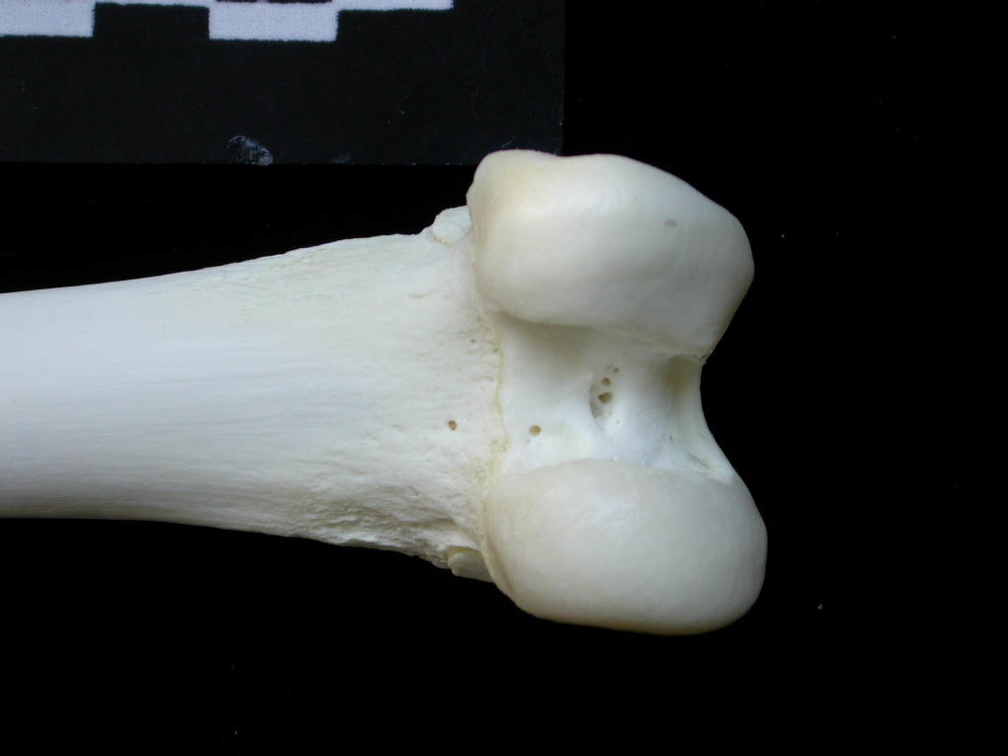 Femur: distal part